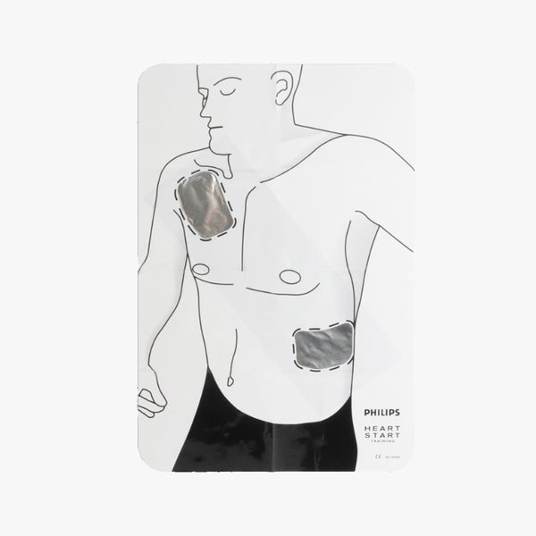 Philips Plansch Electrode placement