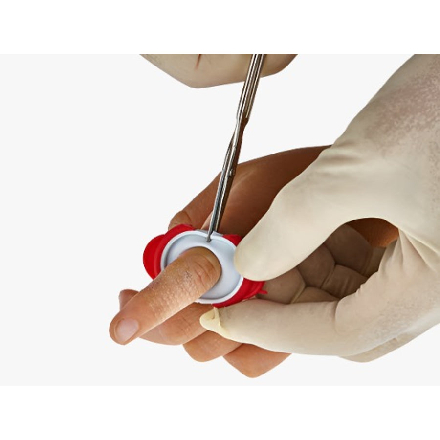 T-RING Flex fingertourniquet