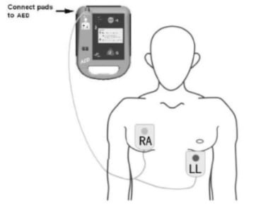 M&B AED7000 voksenelektroder – AED_elektroden
